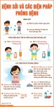 Bài tuyên truyền bệnh sởi